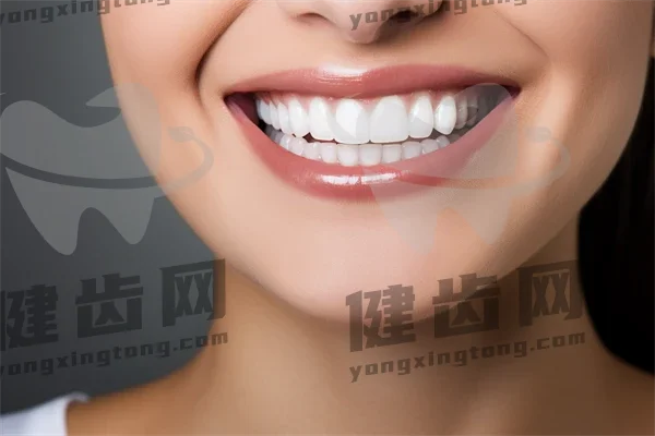 秦皇岛牙齿美白费用是多少？2025年牙齿美白价格一览，超薄瓷贴面美白费用也一并揭晓！